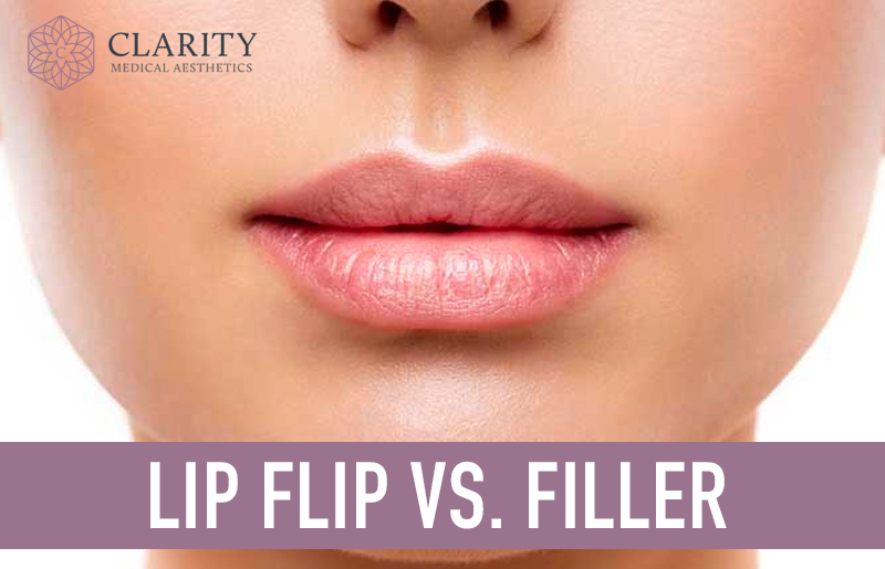 Lip Flip vs. Filler: Everything You Need to Know