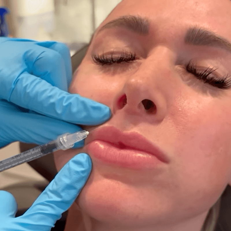 Woman getting lip injection
