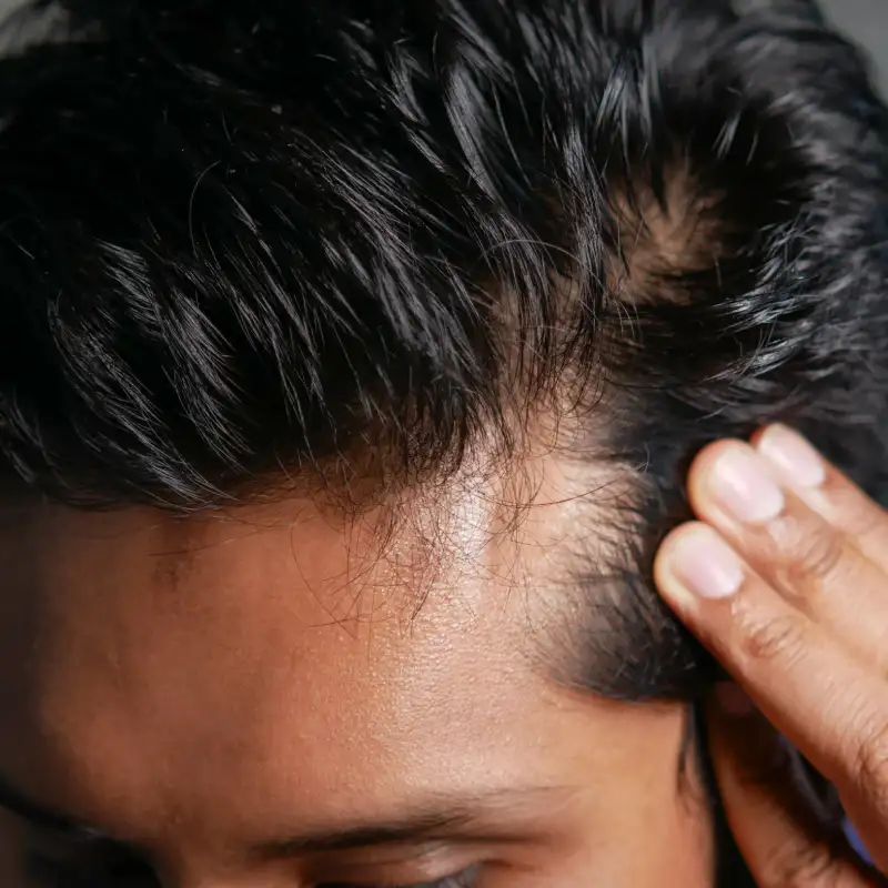 A man with black hair